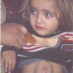 Nur, 2 anni, ferita nel dicembre 2004 all’addome, è in attesa di una nuova operazione. Foto scattata a Beit Hanun nell'aprile 2005.